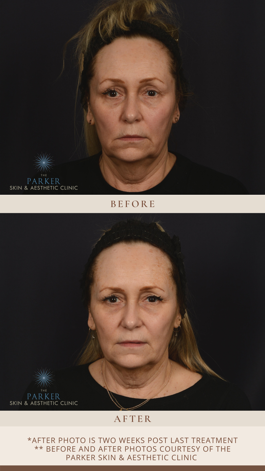 Skintrinsiq™ Before & After